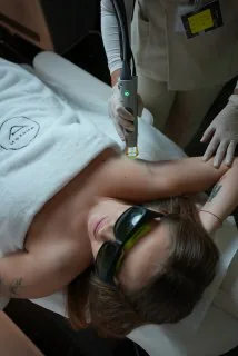 Candela laser treatment at Barvikha Medical Center